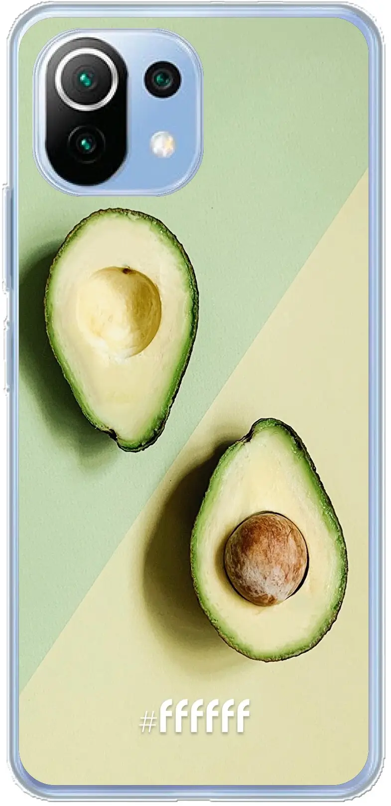 Avocado Aficionado Mi 11 Lite