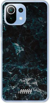 Dark Blue Marble Mi 11 Lite