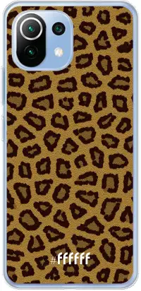 Leopard Print Mi 11 Lite