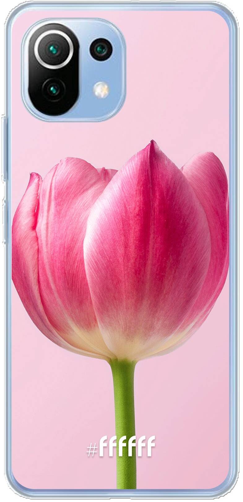 Pink Tulip Mi 11 Lite