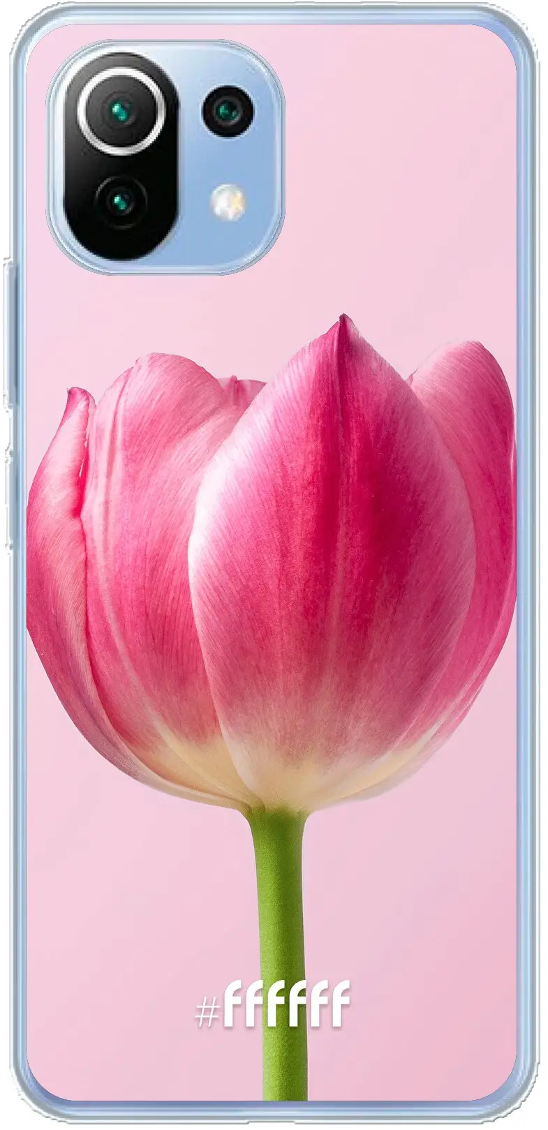 Pink Tulip Mi 11 Lite