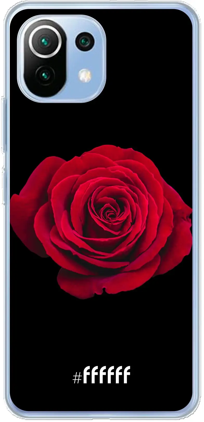 Radiant Rose Mi 11 Lite