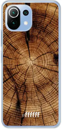 Tree Rings Mi 11 Lite