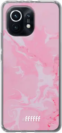 Pink Sync Mi 11